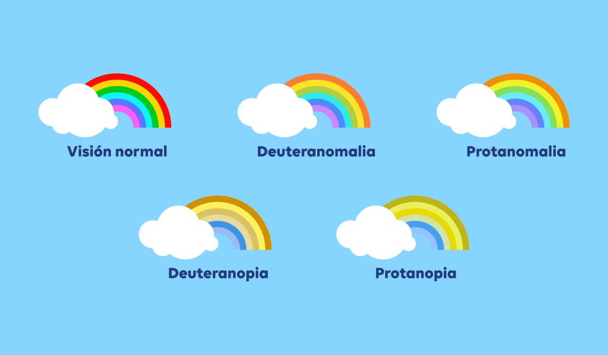 Distintos tipos de daltonismo.